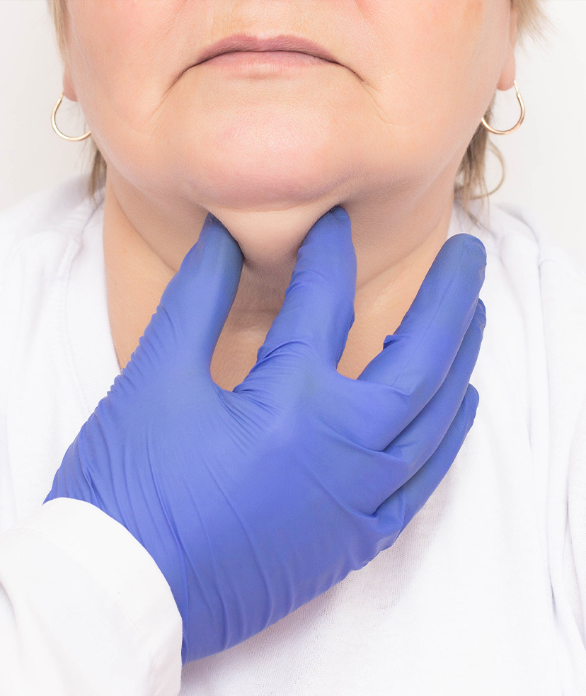 Photo of a woman getting treatments for her double chin
